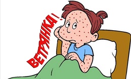 Профилактика ветряной оспы.